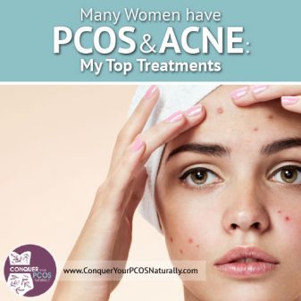 Many Women Have PCOS And Acne: My Top Treatments