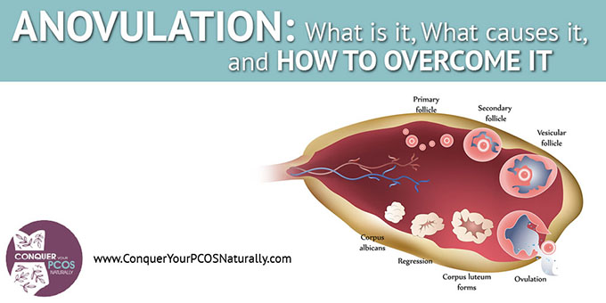 Anovulation: What Is It, What Causes It, And How To Overcome It