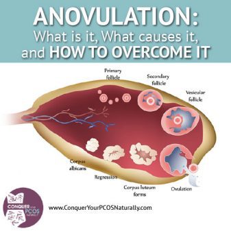 Anovulation: What Is It, What Causes It, And How To Overcome It