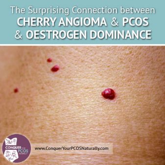 The Surprising Connection Between Cherry Angioma and PCOS and Oestrogen Dominance